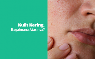 Kulit Kering? Bagaimana Mengatasinya?